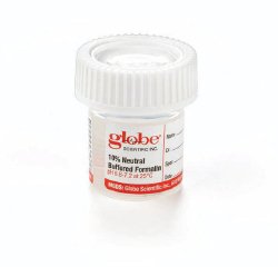 Prefilled_Formalin_Container