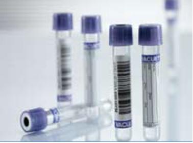 Venous Blood Collection Tube