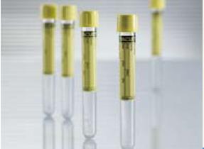 Urinalysis_Tube