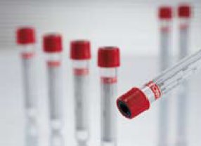 Venous_Blood_Collection_Tube