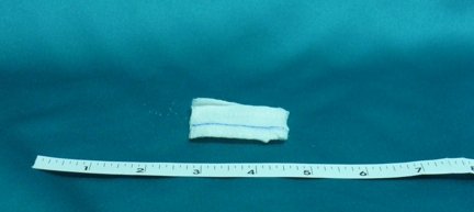 Gauze_Sponge