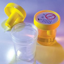 Urine_Specimen_Container_with_Integrated_Transfer_Device