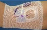 ProNet Elastic Net Retainer Dressing, 8-Inch Length ProNet 2G Medical LLC