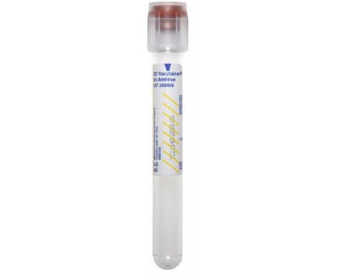 Secondary_Tube