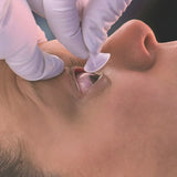 Morgan® Lens Eye Irrigation System
