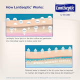 Lantiseptic® Daily Care Skin Protectant, 14-ounce jar Lantiseptic® Dry Skin Therapy DermaRite Industries