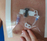 HydroSeal Sleeve 2G Medical LLC