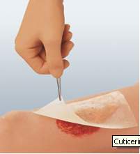 Oil_Emulsion_Impregnated_Dressing